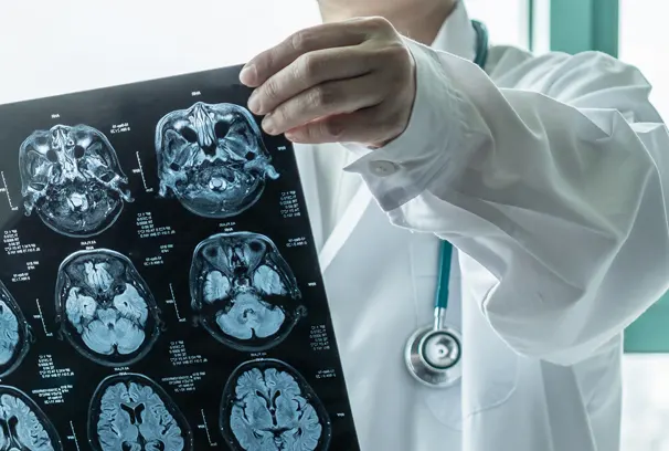 Traumatic Brain Injury